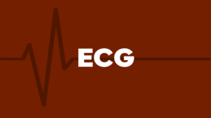 Elettrocardiogramma corso di lettura ECG